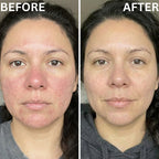 BEAMA Face Mask