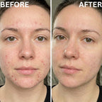 BEAMA Face Mask